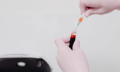 Ultra-prerađena hrana utiče na zdravlje i masnoće u krvi žena