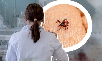 Deset pravila za zaštitu od krpelja tokom letnjih boravaka u prirodi