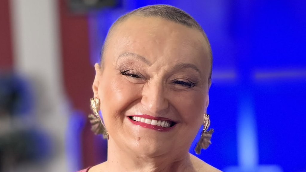 Milica Dugalić otvoreno o borbi sa bolešću: Pojavila se bez perike pred kamerama – karcinom dojke