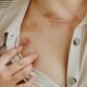 Ljubičasti osip može ukazivati na dermatomiozitis kod žena – ljubicasti osip kod žena