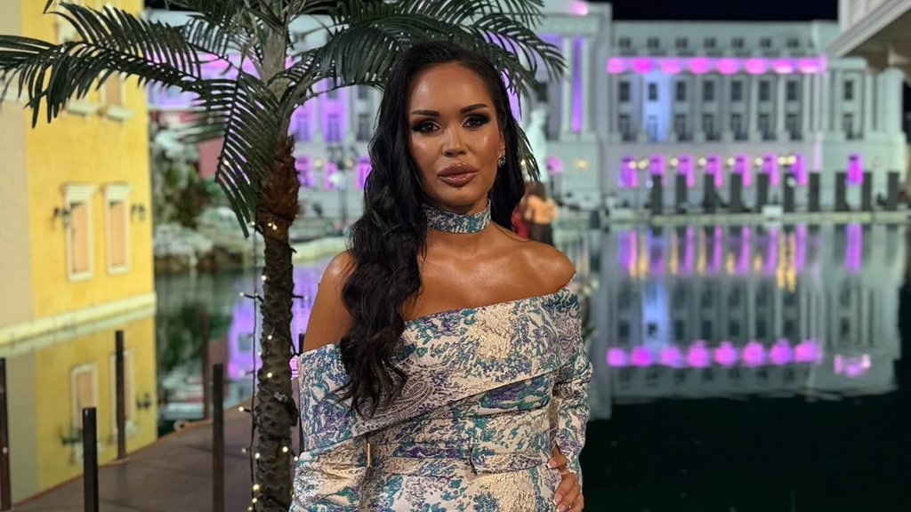 Sandra Obradović pokazala zebrasti kupaći i izazvala reakcije na Instagramu – Sandra Obradović zebrasti kupaći