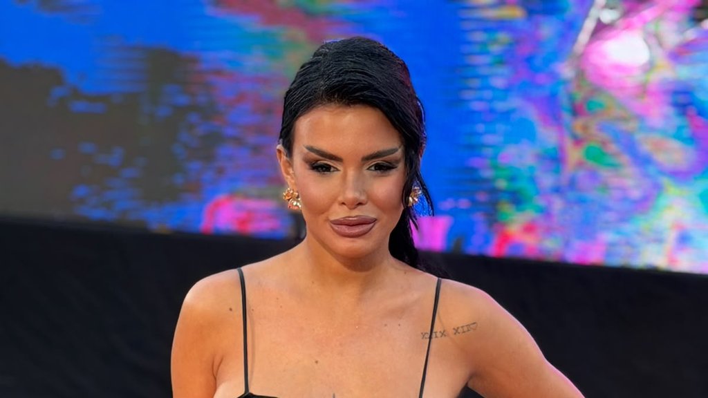 Anita Stanojlović pokazala trudnički stomak i oduševila fanove na Instagramu – Anita Stanojlović trudnički stomak