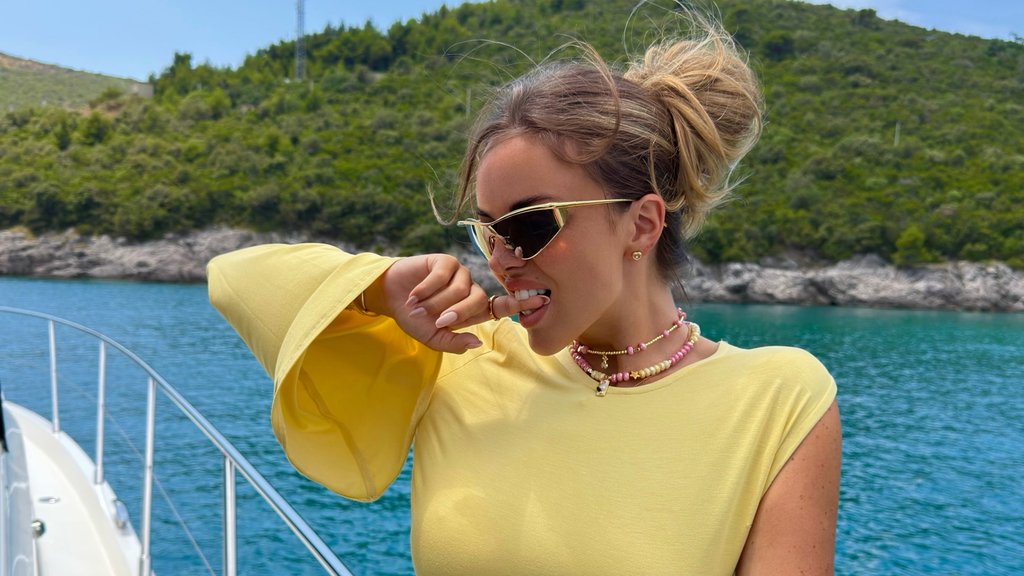 Sofija Šašić progovorila o operacijama nosa: Otkrila kako je podnela promene – operacije nosa