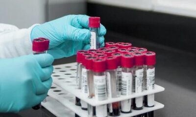 Hantavirus andes otkriven kod putnika iz Francuske, pojačan nadzor u Evropi