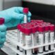 Hantavirus andes otkriven kod putnika iz Francuske, pojačan nadzor u Evropi