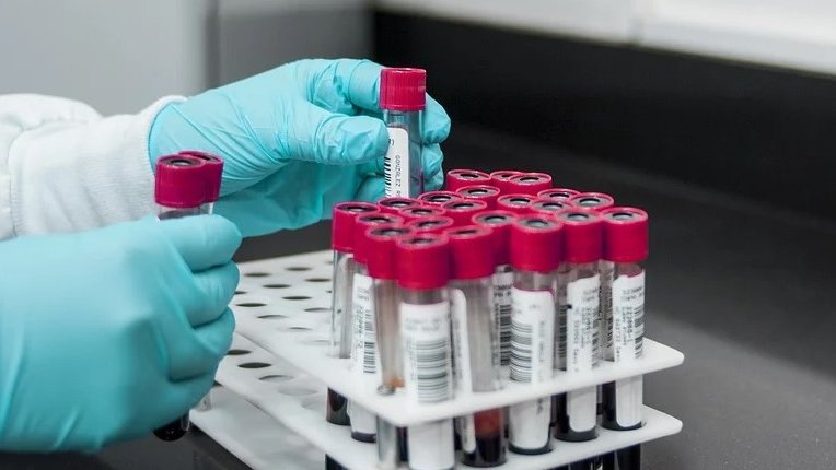Hantavirus andes otkriven kod putnika iz Francuske, pojačan nadzor u Evropi