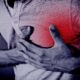 heart attack, illness, health, chest pain, cardiology, medicine, myocardial infarction, heart attack, heart attack, heart attack, heart attack, heart attack