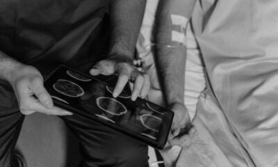 Majka petoro dece se bori sa neoperabilnim tumorom na mozgu – neoperabilni tumor na mozgu