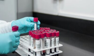 Virus Zapadnog Nila u Rumuniji: 58 zaraženih, tri osobe preminule