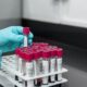 Virus Zapadnog Nila u Rumuniji: 58 zaraženih, tri osobe preminule