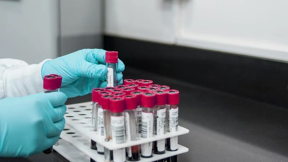 Virus Zapadnog Nila u Rumuniji: 58 zaraženih, tri osobe preminule