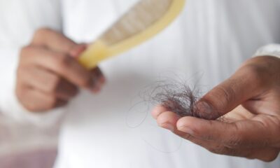 Lekovi za mršavljenje povezani sa pojačanim opadanjem kose kod muškaraca
