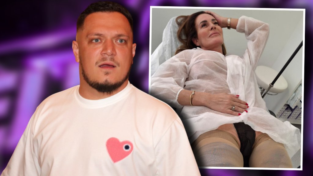 RAZMENILI OŠTRE KOMENTARE NA INSTAGRAMU: Milena Kačavenda odgovorila Gastozu nakon poređenja operacije sa mumificiranjem (FOTO) – operacija Milene Kačavende