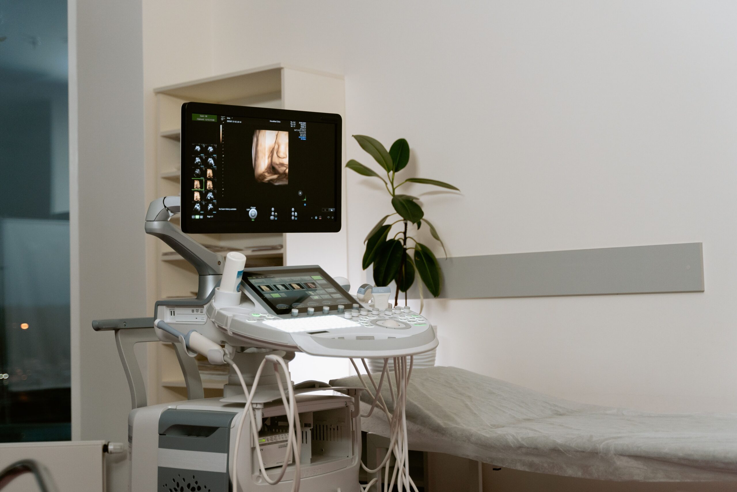 Važnost rane dijagnostike osteoporoze: Šta žene treba da znaju – prevencija osteoporoze