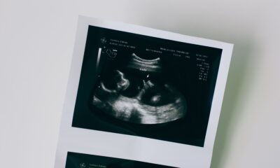 Genetski pregled embriona sve češći izbor među ženama