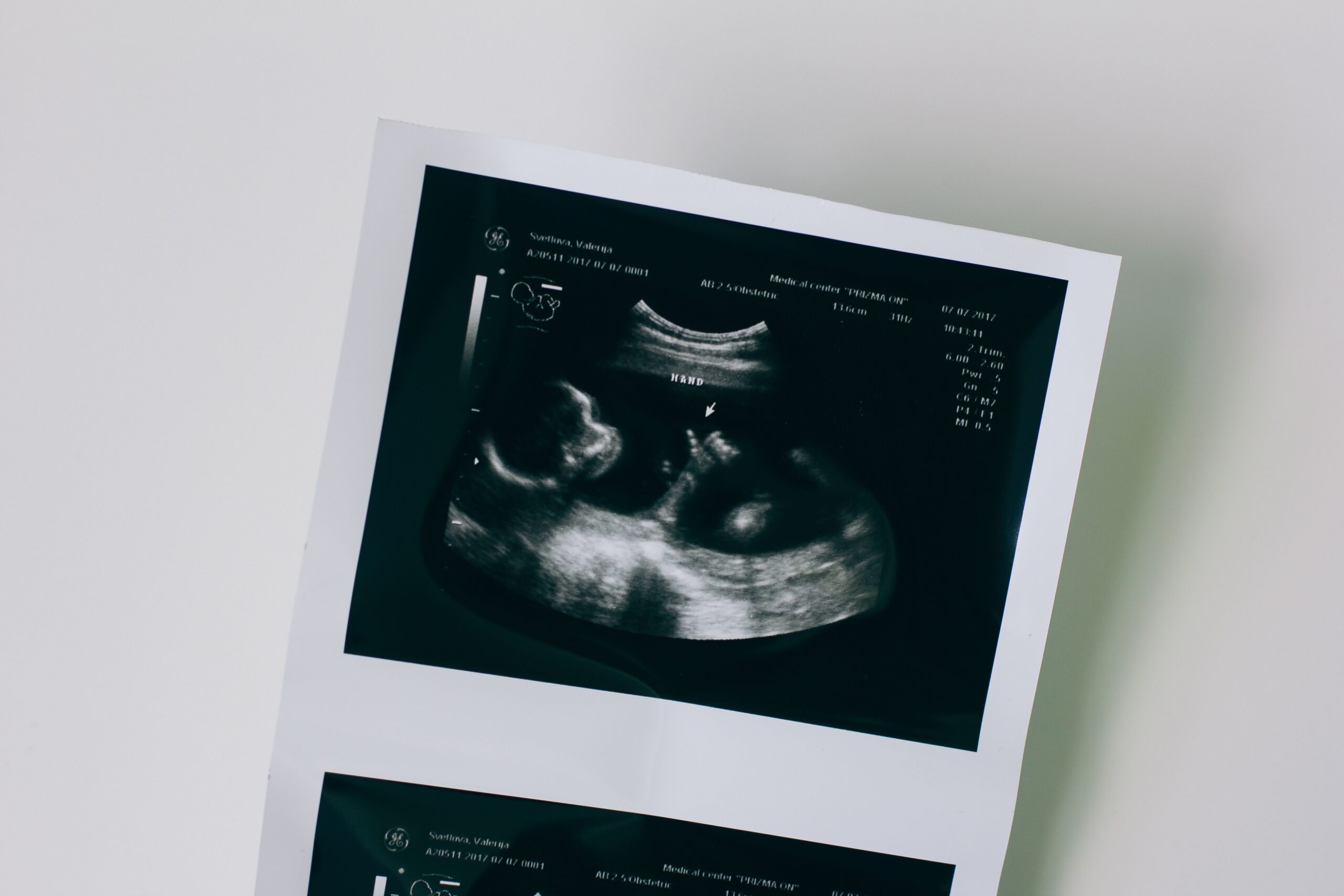 Genetski pregled embriona sve češći izbor među ženama