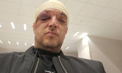 MISTERIJA OKO NAPADA NA ZORANA MARJANOVIĆA: Odbija saradnju sa policijom, povrede zadobio u stanu na Paliluli (FOTO) – napad u Beogradu