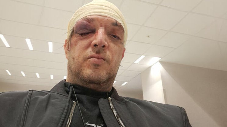 MISTERIJA OKO NAPADA NA ZORANA MARJANOVIĆA: Odbija saradnju sa policijom, povrede zadobio u stanu na Paliluli (FOTO) – napad u Beogradu
