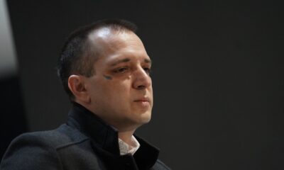 NOĆ UZNEMIRENJA ZA ZORANA MARJANOVIĆA: Detalji zdravstvenog stanja nakon napada i kontuzije mozga (FOTO) – napad u Beogradu