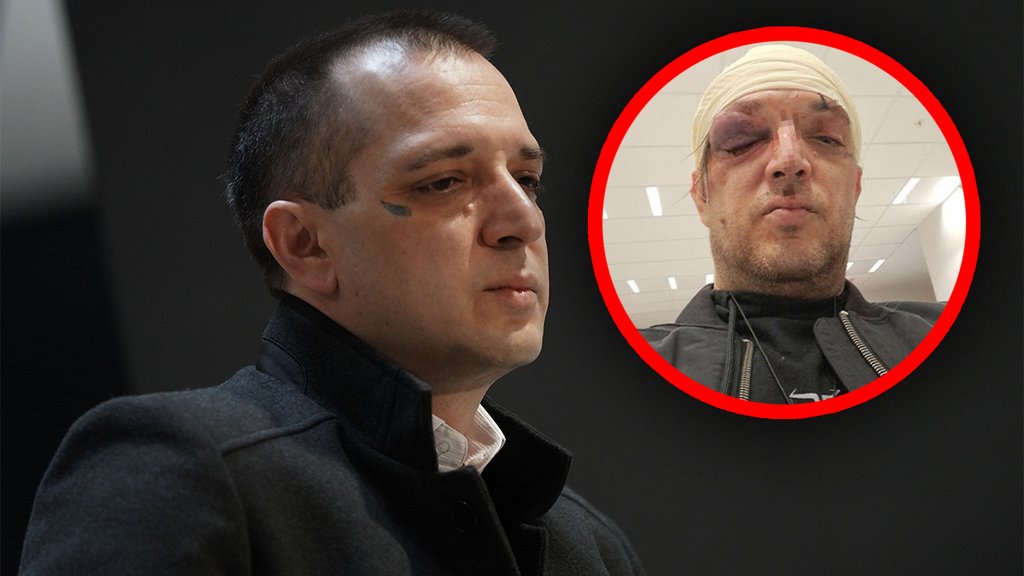 NEIZVESTAN RASPLET POSLE DRAMATIČNE NOĆI: Zoran Marjanović pretučen tokom sukoba u stanu na Karaburmi (FOTO) – napad u Beogradu
