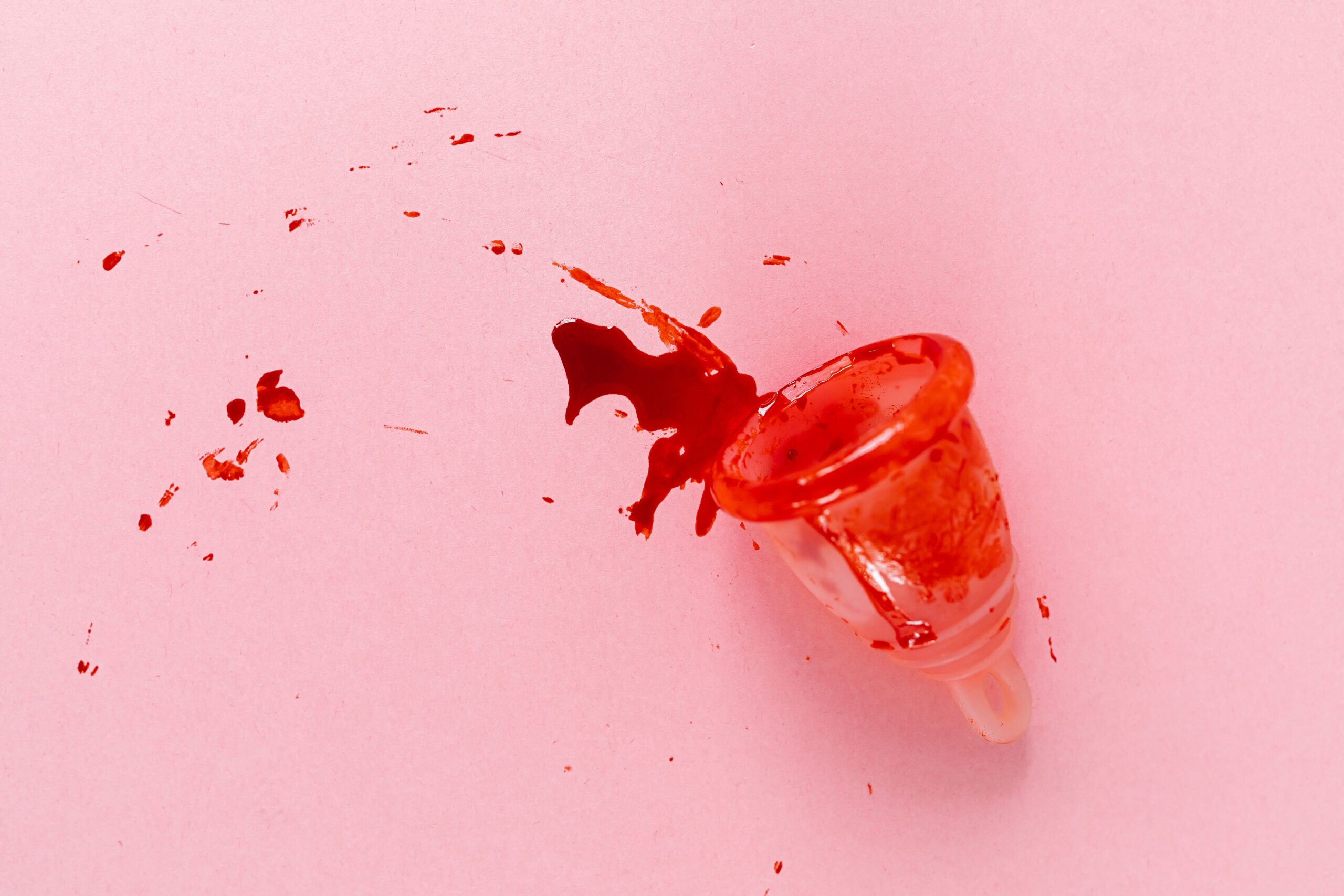 Menstruacija dva puta mesečno: Šta svaka žena treba da zna