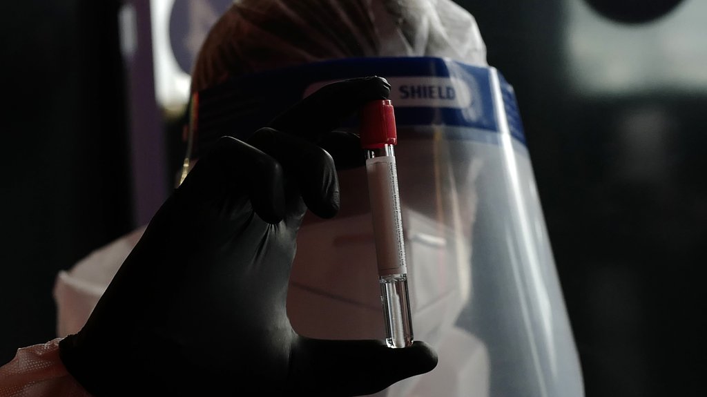 SZO traži informacije od Rusije: Šta stoji iza upale pluća kod laboratorijskih radnika? – upala pluća kod laboratorijskih radnika