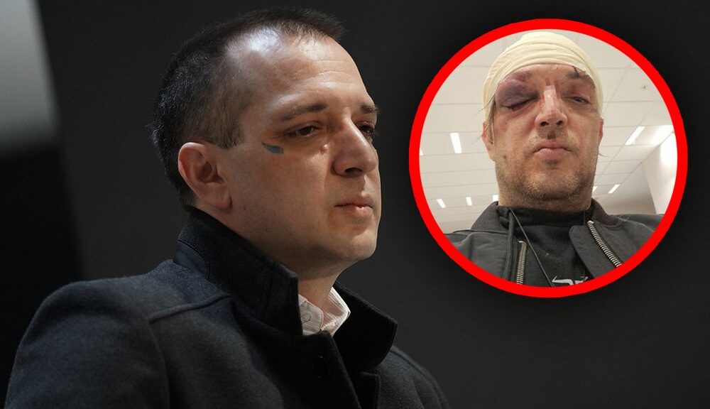 Zoran Marjanović nakon prebijanja ne izlazi iz kuće: Suđenje odloženo zbog povreda – napad na Zorana Marjanovića