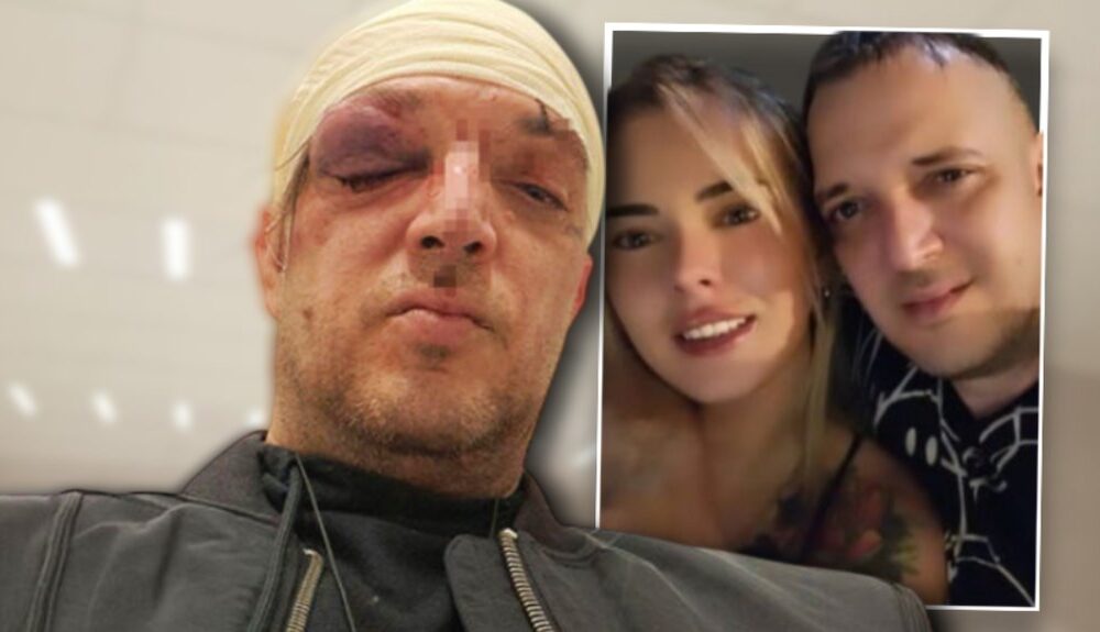 KAKO JE JEDNA ZABAVA PROMENILA SVE: Zoran Marjanović pretučen tokom incidenta u stanu na Paliluli (FOTO) – napad u Beogradu