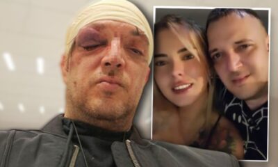 KAKO JE JEDNA ZABAVA PROMENILA SVE: Zoran Marjanović pretučen tokom incidenta u stanu na Paliluli (FOTO) – napad u Beogradu