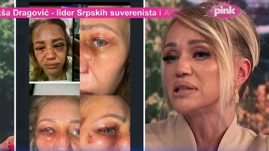 MESEC DANA POTRAGE ZA NASILNIKOM: Uhapšen muškarac osumnjičen za napad na Kristinu Živković (FOTO)