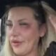 MONIKA IVKIĆ UZNEMIRILA JAVNOST: Pevačica pokazala modricu i ispričala detalje napada nakon nastupa u Ofenbahu (FOTO) – napad u Ofenbahu