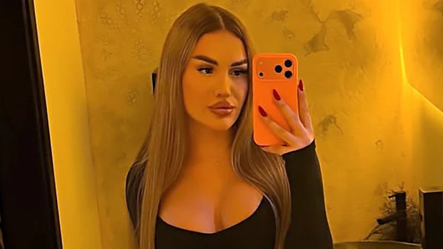 NIKOLINA KOVAČEVIĆ O NAJLIČNIJOJ PROMENI: Influenserka otvoreno o tranziciji i oporavku nakon operacije (FOTO) – tranzicija Nikoline Kovačević
