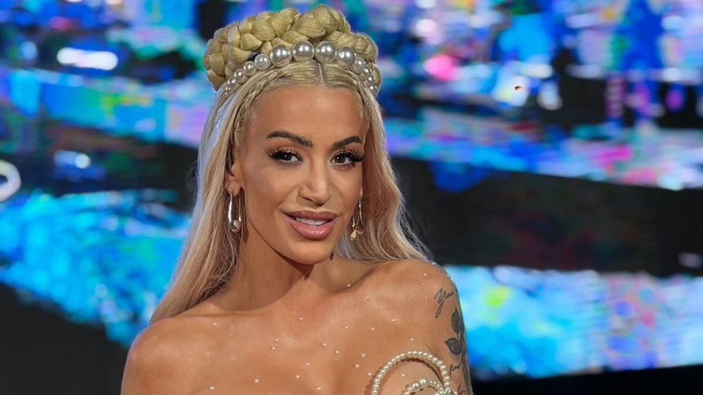 IZAZVALA BURU NA DRUŠTVENIM MREŽAMA: Dušica Jakovljević otkrila detalje povrede posle nezgode (FOTO) – Dušica Jakovljević povrede