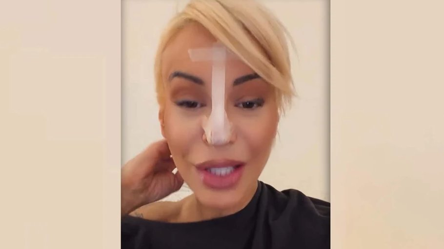 DUŠICA JAKOVLJEVIĆ IZAZVALA REAKCIJE NA DRUŠTVENIM MREŽAMA: Otkrila novu tehniku za podizanje vrha nosa (FOTO) – Dušica Jakovljević nos