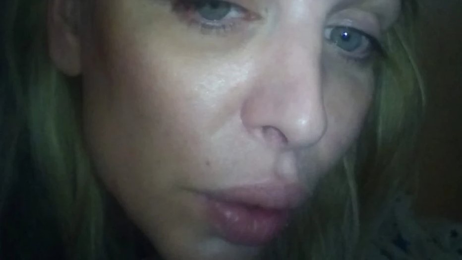 DRAMATIČNI TRENUTCI NA DRUŠTVENIM MREŽAMA: Ava Karabatić objavila fotografije povreda i iznela optužbe na račun bivšeg partnera (FOTO) – nasilje u vezi